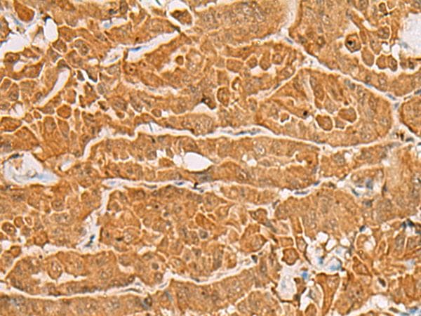 Polyclonal Rabbit anti-Human MAPK14 / p38 Antibody (IHC)