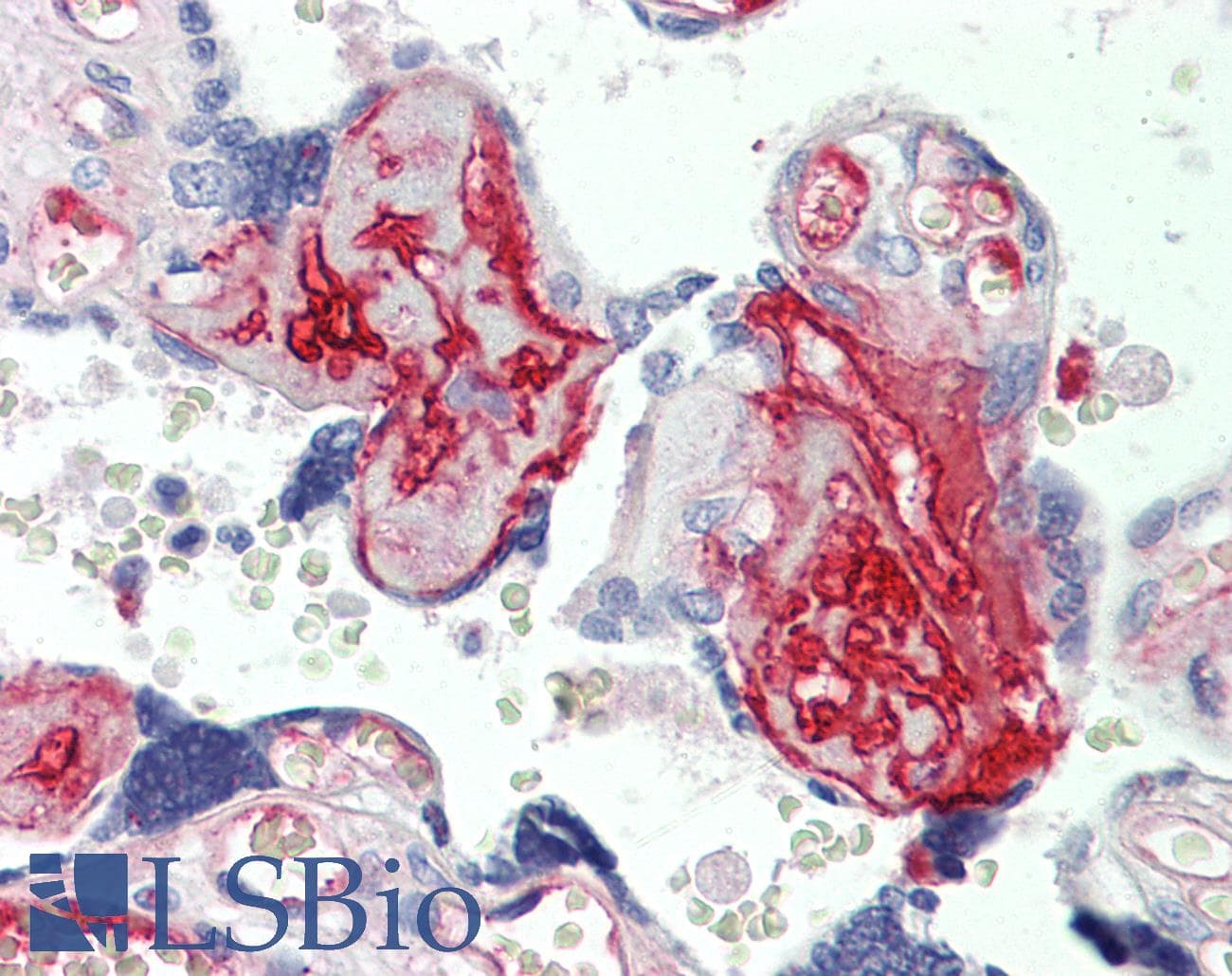IHC-plus™ FN1 / Fibronectin Antibody (aa1965-2176, clone 2F4)