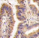 Polyclonal Rabbit anti-Human TGM2 / Transglutaminase 2 Antibody (Lys444, IHC, IF, WB)