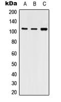 ATP2A2 / SERCA2 Antibody (Internal)