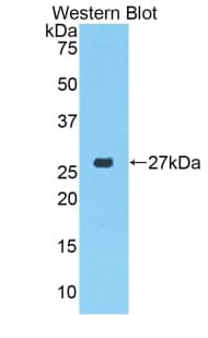 CTGF Antibody (aa101-330)