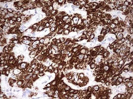 OTC Antibody (aa33-354, clone OTI7B1)