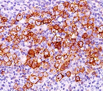 CD30 Antibody (clone CD30/412)