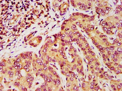 DPPA5 Antibody