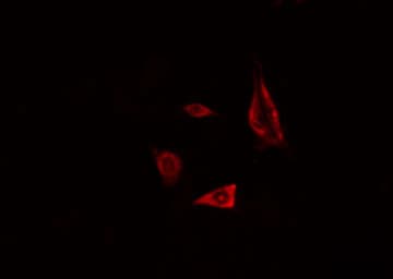 Polyclonal Rabbit anti-Human TNFAIP3 / A20 Antibody (IHC, IF, WB)