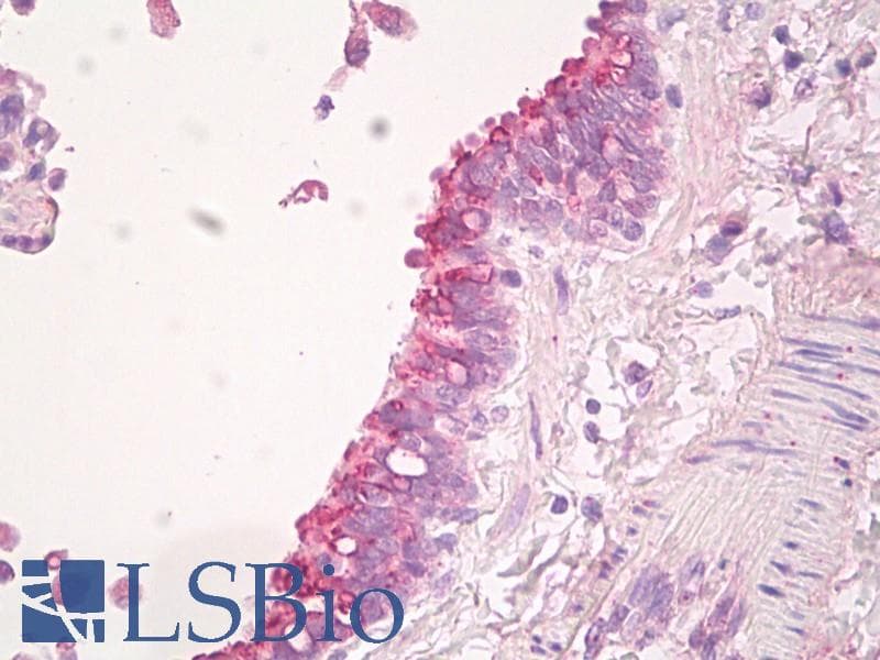 Polyclonal Rabbit anti-Human LIMPII / SCARB2 Antibody (aa25-74, IHC, WB)