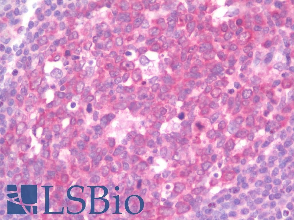 IHC-plus™ IL17RE Antibody