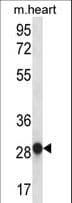 Polyclonal Rabbit anti-Human MYOG / Myogenin Antibody (aa1-30, WB)