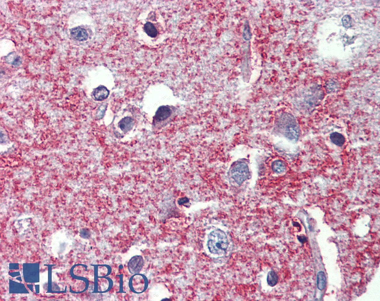 IHC-plus™ Polyclonal Rabbit anti-Human SHROOM2 Antibody (IHC, WB)
