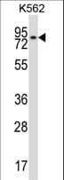 REC8 Antibody (aa194-222)