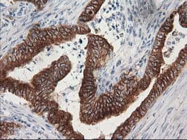 TUBB4 / Tubulin Beta 4 Antibody (clone 3C12, Carrier-free)