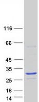 Human SSX3 Protein (Recombinant Myc-DDK (Flag))