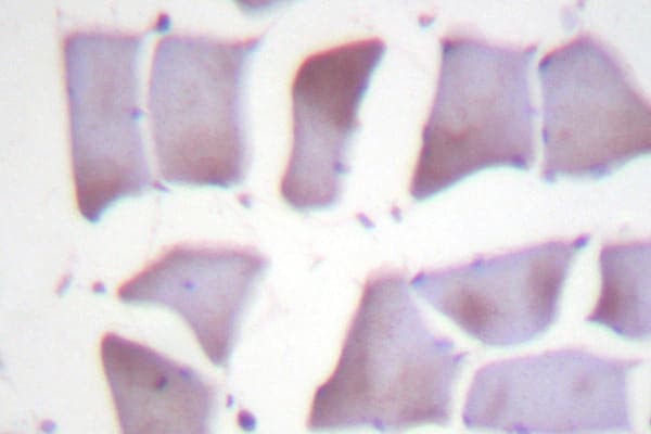 PEA15 / PEA-15 Antibody (Asp110)