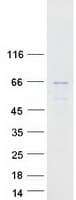 Human PIP5K1B Protein (Recombinant Myc-DDK (Flag))