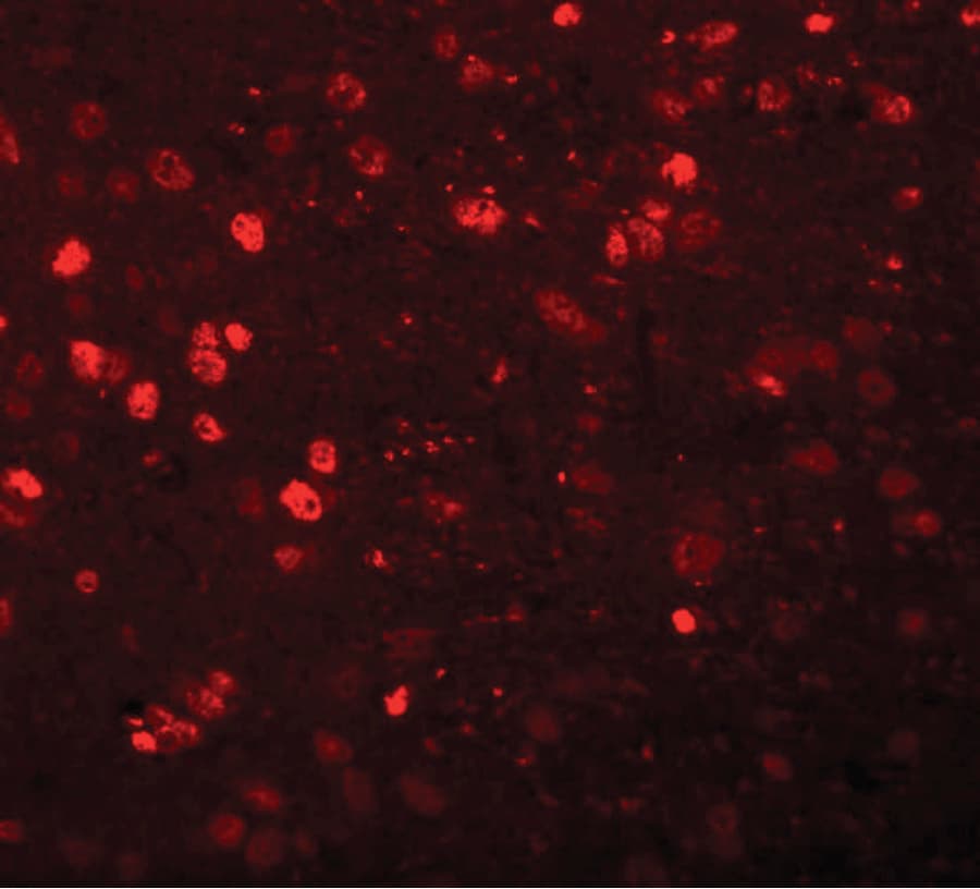 IHC-plus™ Polyclonal Rabbit anti-Human SYNGR1 / Synaptogyrin 1 Antibody (IHC, IF, WB)