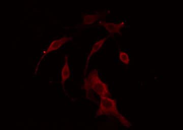 Polyclonal Rabbit anti-Human LRAT Antibody (IHC, IF, WB)