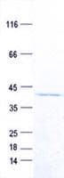 Human DLG2 / PSD93 Protein (Recombinant His, N-Terminal)