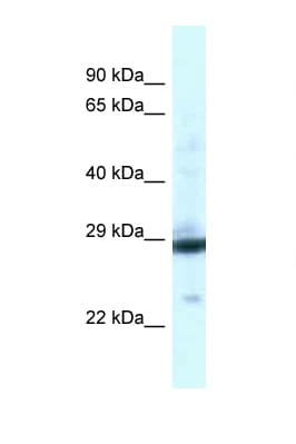 PGAM1 Antibody (aa130-179)