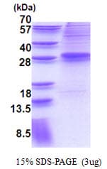 Human MECOM / EVI1 Protein (Recombinant His)
