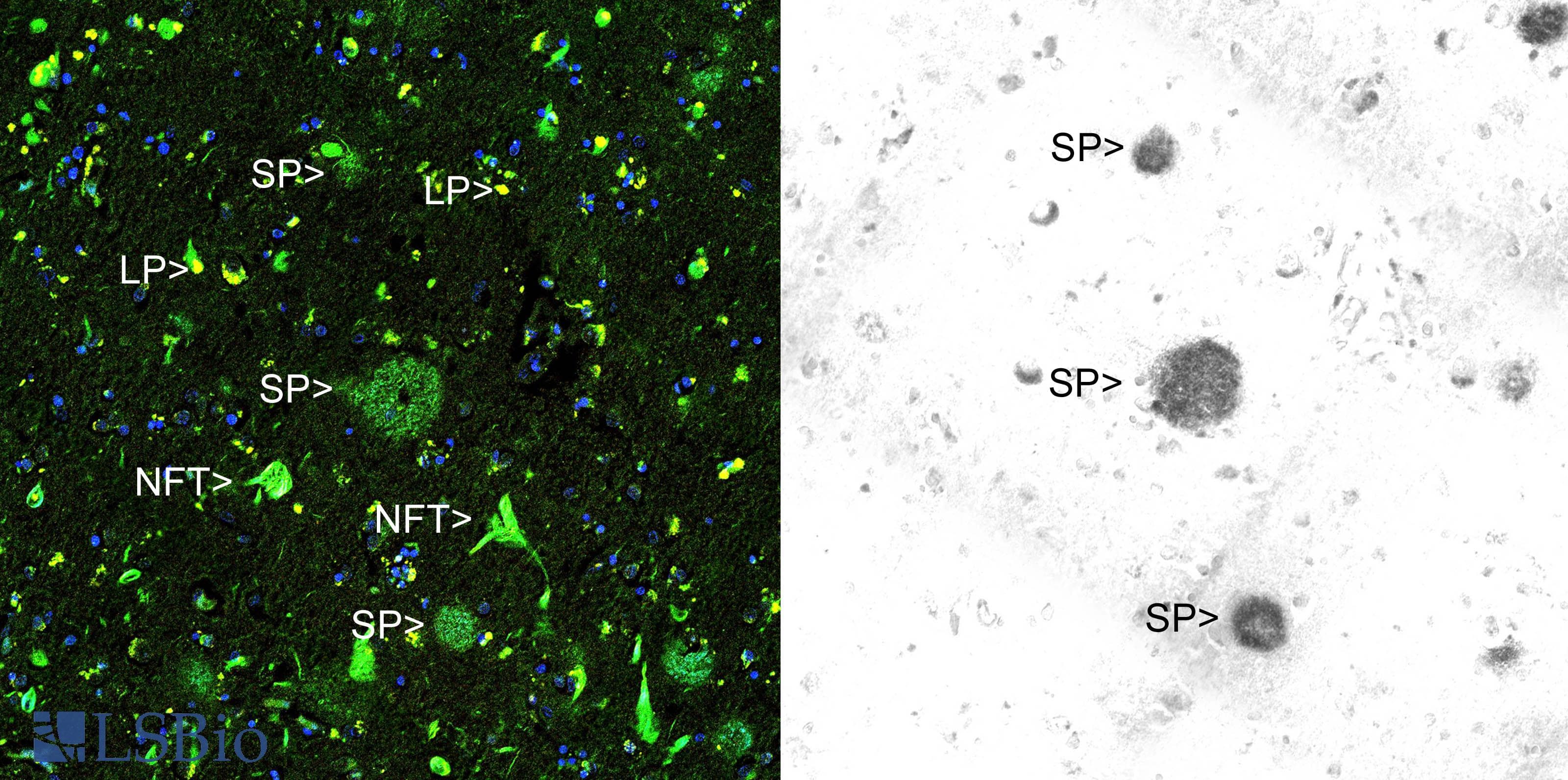 Beta Amyloid Antibody (clone AB9)