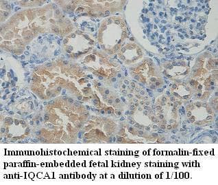 Polyclonal Rabbit anti-Human IQCA Antibody (aa178-367, IHC, WB)