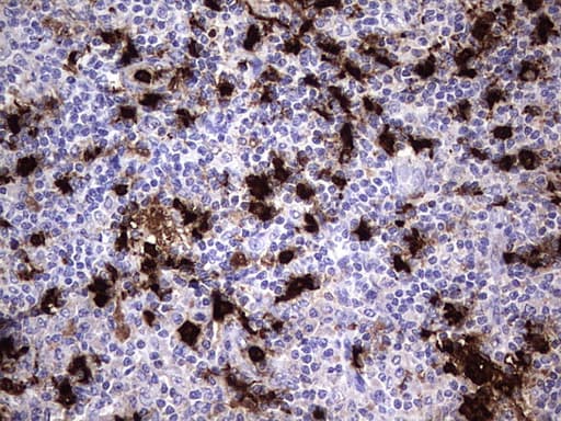 S100A9 / MRP14 Antibody (clone OTI11A12)