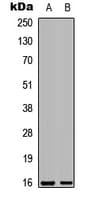 LGALS7 / Galectin 7 Antibody (Internal)