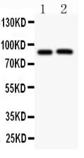 APP / Beta Amyloid Precursor Antibody (aa672-713)