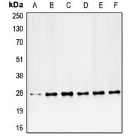 PDGF-BB Antibody (Internal)