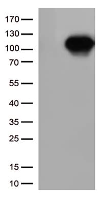 SIRT1 / Sirtuin 1 Antibody (aa552-676, clone OTI1H1)