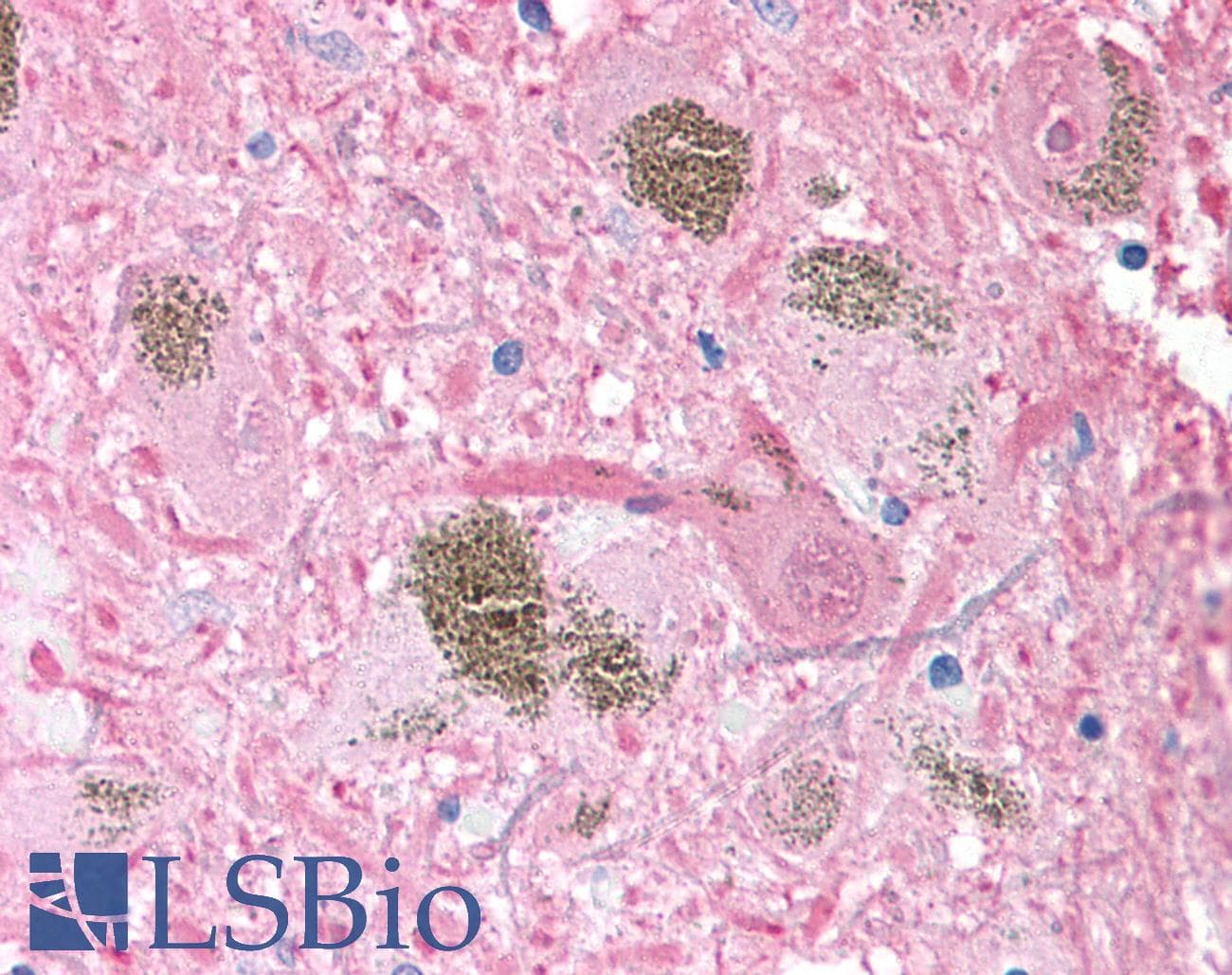 UCHL1 / PGP9.5 Antibody (Internal, Biotin)