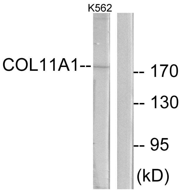Polyclonal Rabbit anti-Human COL11A1 / Collagen XI Alpha 1 Antibody (WB)