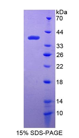 Human IFI35 Protein (Recombinant His-S)
