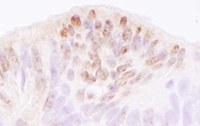TRERF1 Antibody (aa1150-1200)