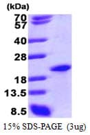 Human SAP18 Protein (Recombinant His)