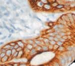 Monoclonal Mouse anti-Human KRT20 / CK20 / Cytokeratin 20 Antibody (clone Ks20.8, Ready-to-Use, IHC)