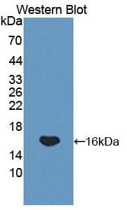 GP1BB / CD42c Antibody (aa52-164, APC)