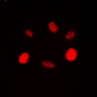 Polyclonal Rabbit anti-Human RAD54L Antibody (Internal, IHC, IF, WB)