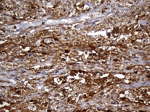 M-PST / STM Antibody (clone OTI6A8)