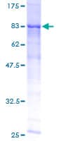 Human ME1 / Malate Dehydrogenase Protein (Recombinant GST)