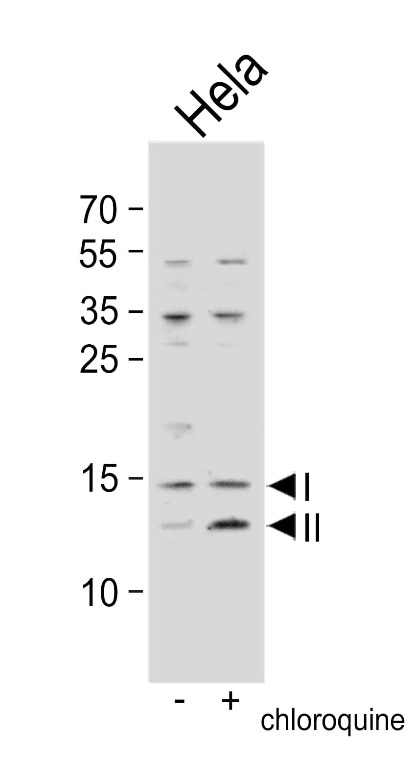 Polyclonal Rabbit anti-Human MAP1LC3B / LC3B Antibody (aa1-30, IHC, IF, WB)