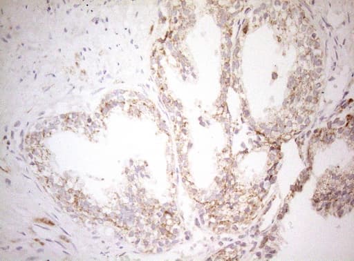 DECR1 Antibody (clone OTI7B11)