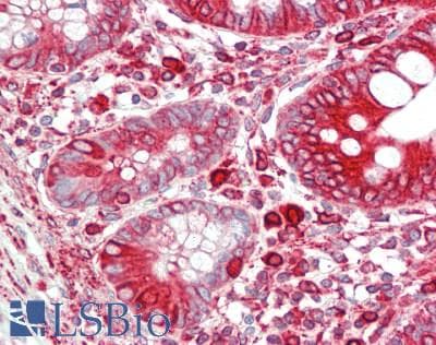 PathPlus™ CANX / Calnexin Antibody (aa543-592)