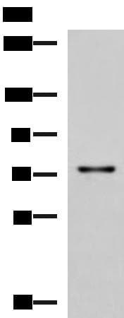 Polyclonal Rabbit anti-Human TGFBI Antibody (IHC, WB)