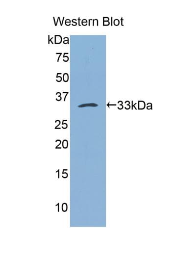 BLMH Antibody (aa213-447)
