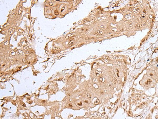 Polyclonal Rabbit anti-Human HOXC9 Antibody (IHC, WB)