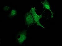 ZFAND2B Antibody (clone OTI3A2)