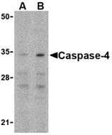 IHC-plus™ Polyclonal Rabbit anti-Human CASP4 / Caspase 4 Antibody (IHC, WB)