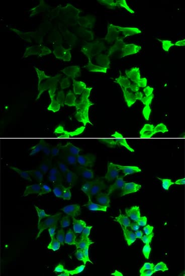 TANK Antibody