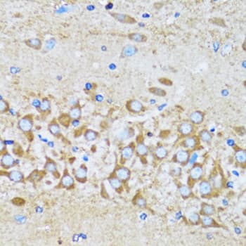 Polyclonal Rabbit anti-Human ACTR2 / ARP2 Antibody (IHC, IF, WB)